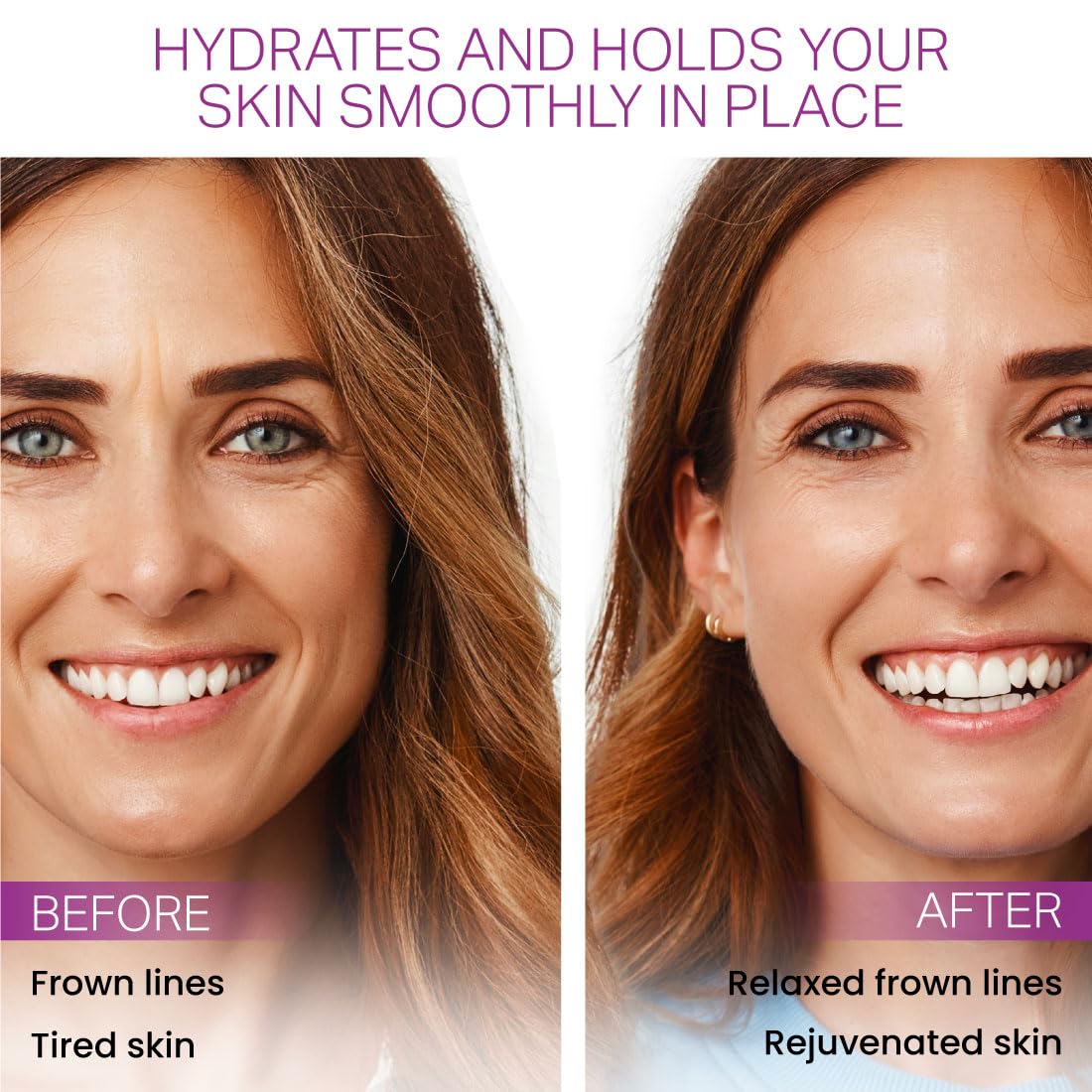 Furlesse Elevens Wrinkle Patches, Overnight Wrinkle Patches for Frown Lines, Non-Invasive Anti-Wrinkle Patches, Anti-Aging Skincare, 30 Patches, 30-Day Use