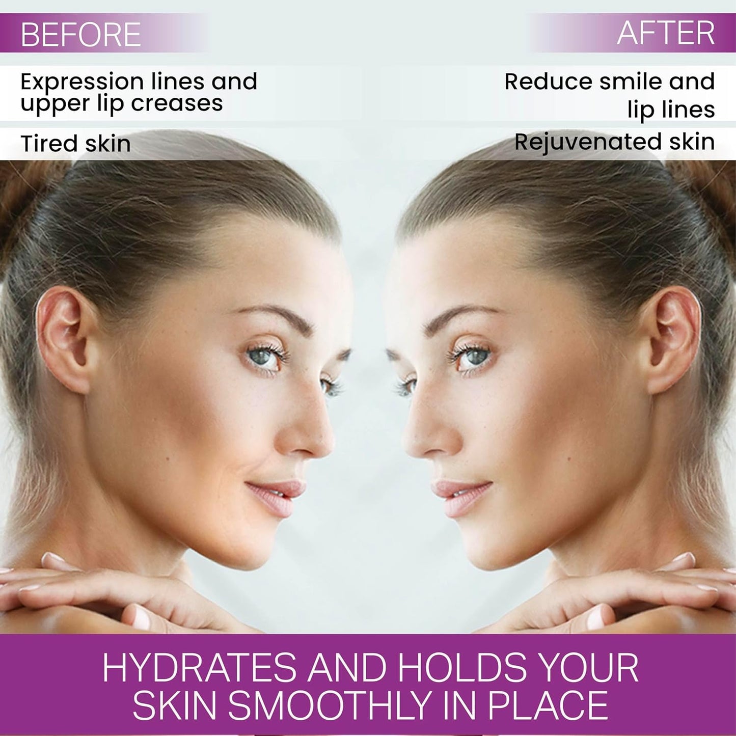 Furlesse Lip-Sticks Wrinkle Patches, Overnight Anti-Wrinkle Patches for Smile Lines, Fine Lines, and Expression Lines, Non-invasive Lip Patches, Anti-aging Skincare, 120 Patches, 30-Day Use